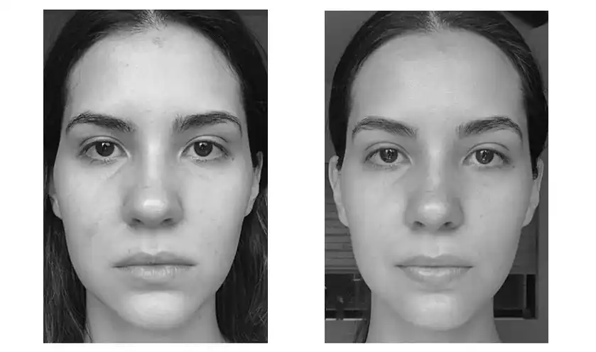 face-yoga-before-after-2