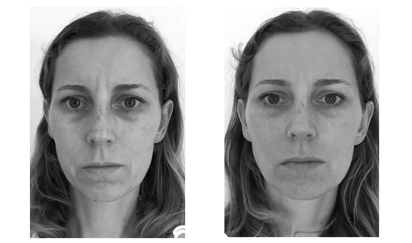 face-yoga-before-after-5
